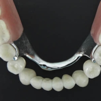 FP Prótesis Dentales a Distancia