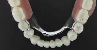 FP Prótesis Dentales a Distancia
